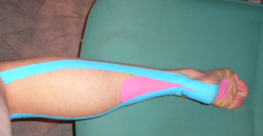 kinesiotape_right_heel